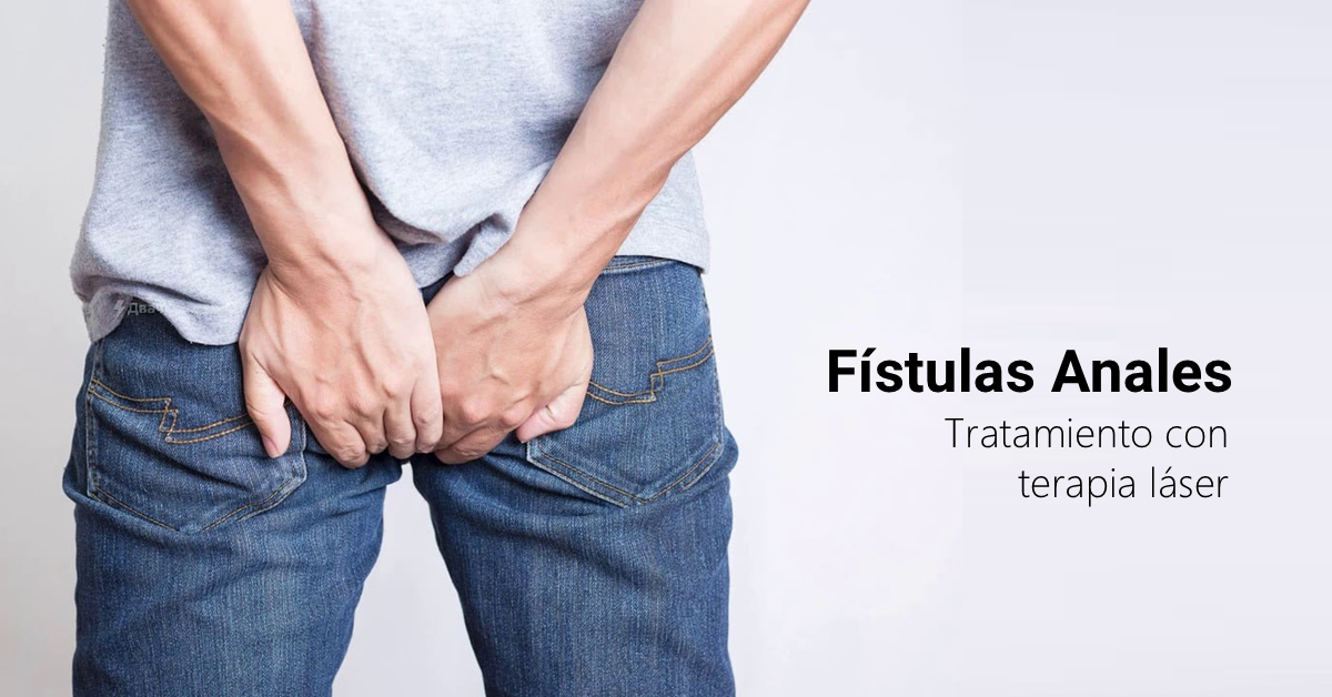 Hombre con fístulas anales con láser