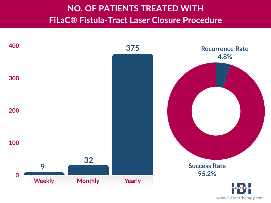 FiLaC® Anal Fistula Procedure - Fistulas Fissures Treatment | Types, Treatments, Prevention Tips