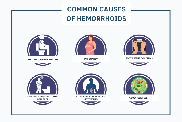 Infographic showing common causes of hemorrhoids, including straining, and pregnancy