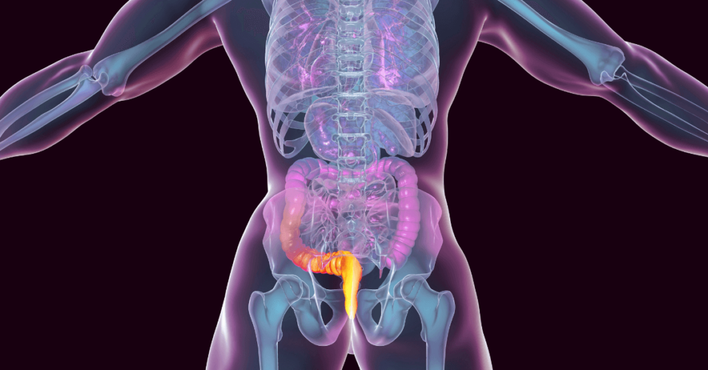 Hemorrhoid Solution in Loganville