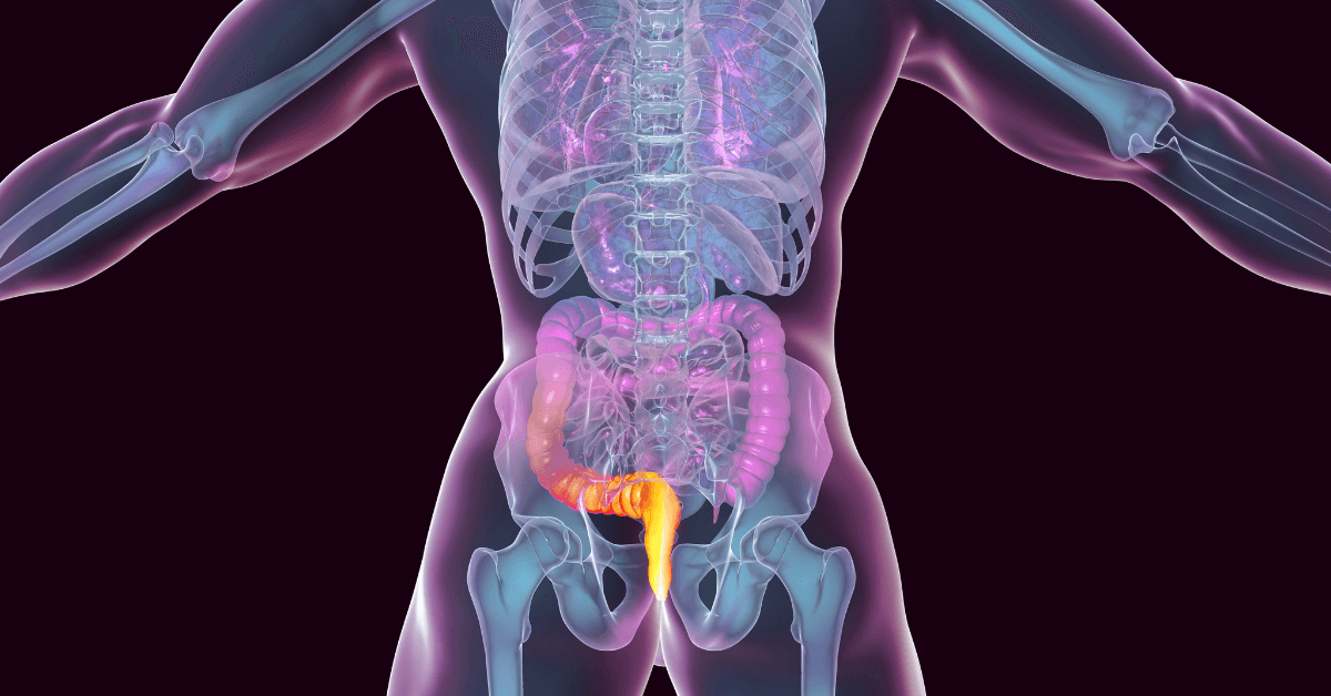 Hemorrhoid Solution in Loganville