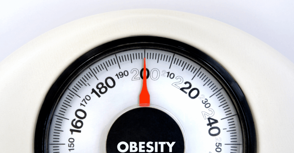 Pilonidal Cysts and Obesity