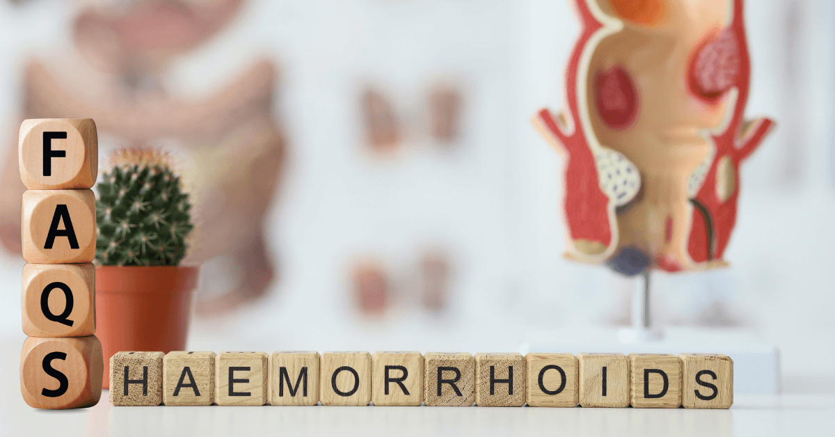Hemorrhoids FAQs