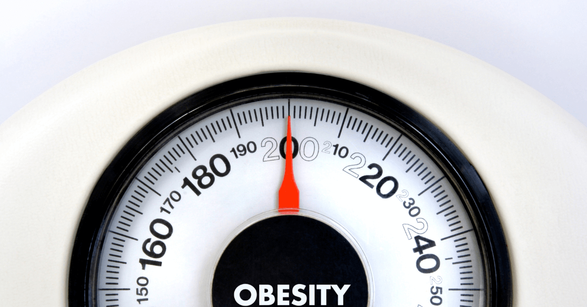 Pilonidal Cysts and Obesity