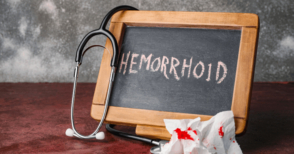 Can Hemorrhoids Come Back?