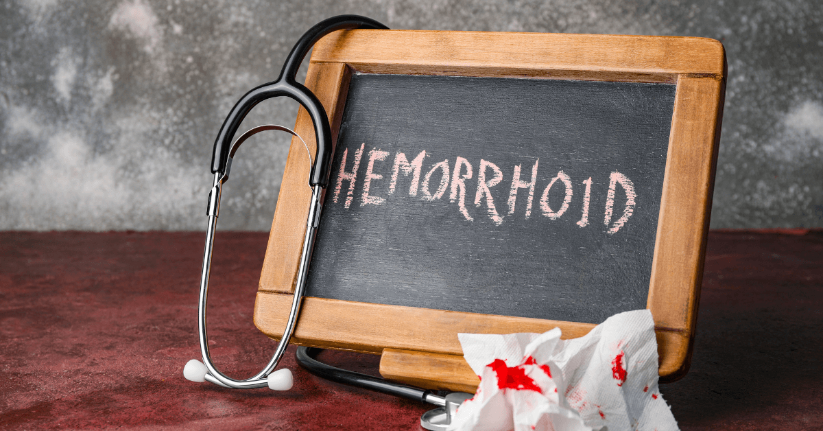 Can Hemorrhoids Come Back?